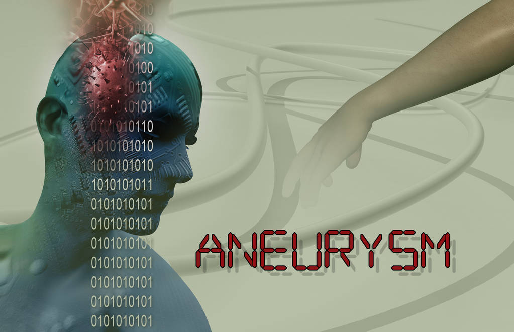Understanding Brain Aneurysms: Symptoms, Diagnosis, and Treatment