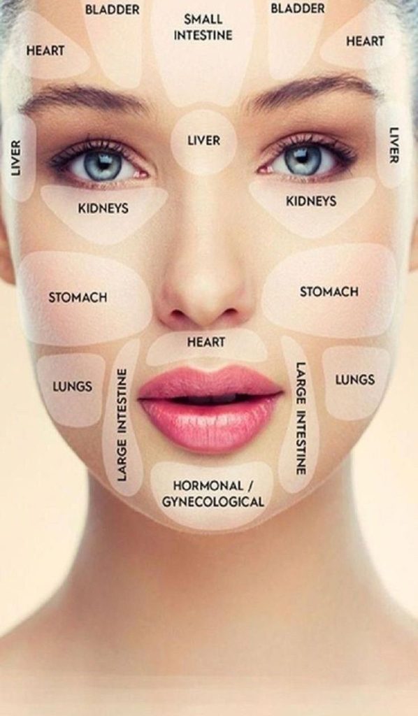 Face Mapping: What Your Pimples are Trying to Tell You, Get Clear Skin Fast Naturally at Home
